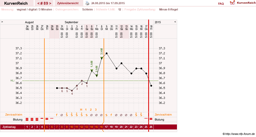 NFP-Kurve User #9764